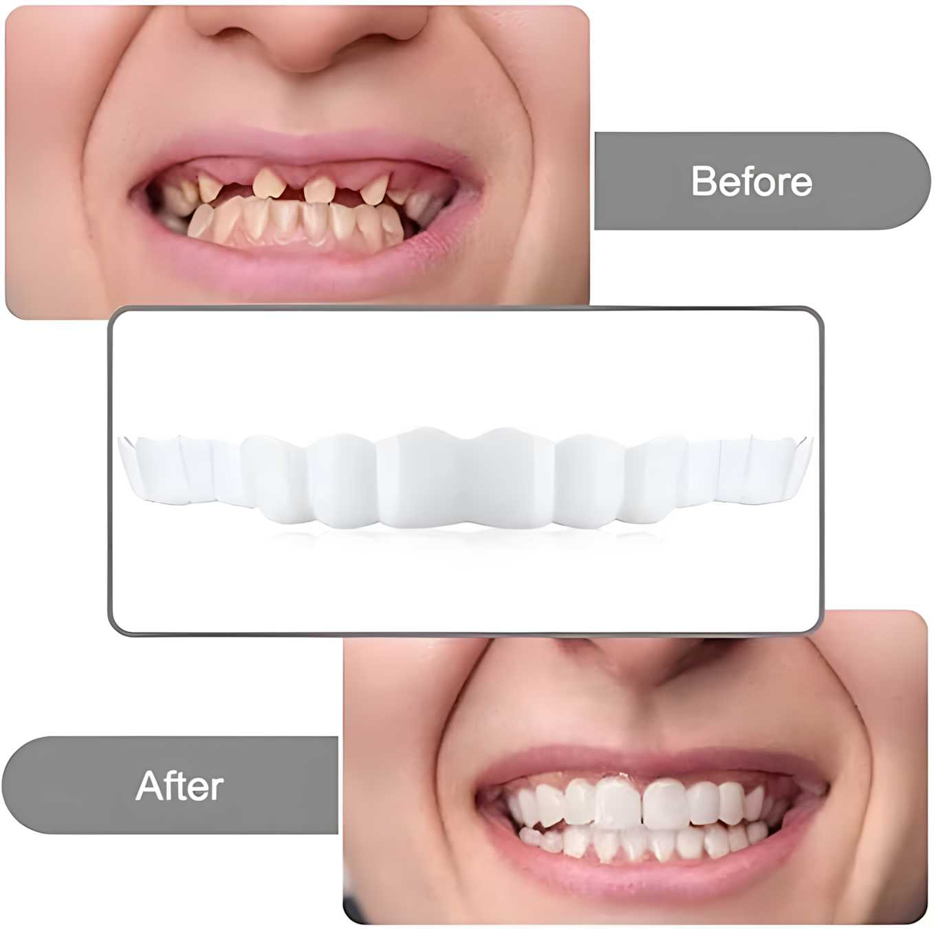2pcs Whitening Teeth Guard for Grinding Protection